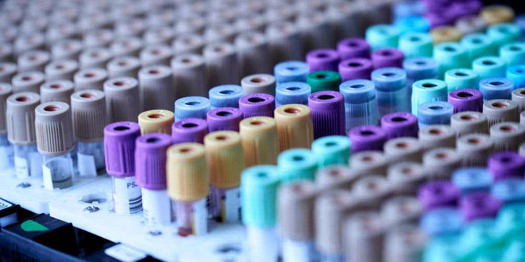 10 Important Blood Tests Everyone Should Consider for Optimal Health