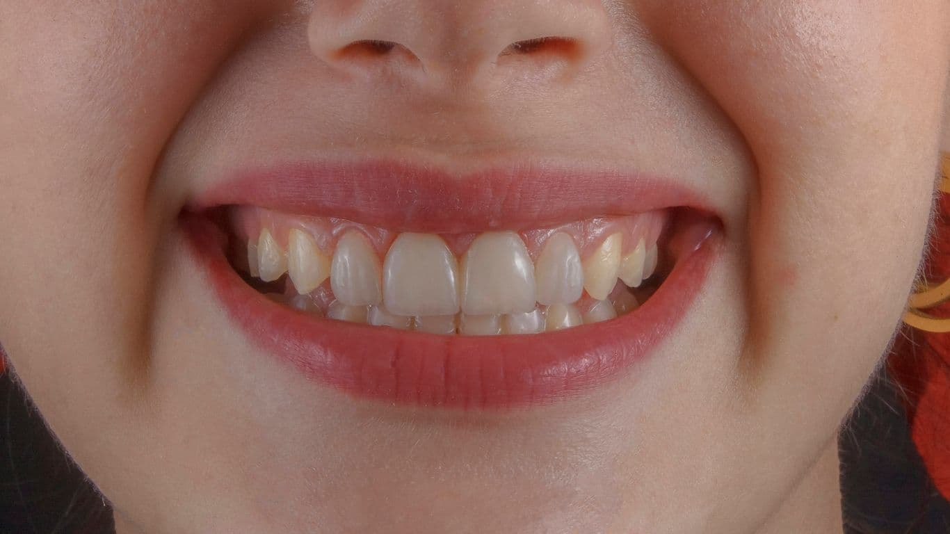 How to Improve Your Dental Health Naturally