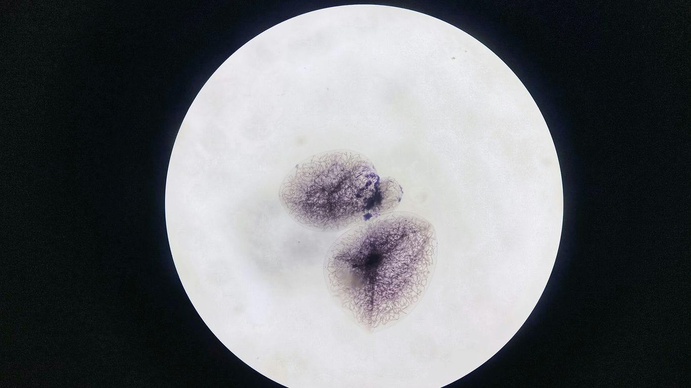 What Is Cellular Senescence and Can You Reverse It?